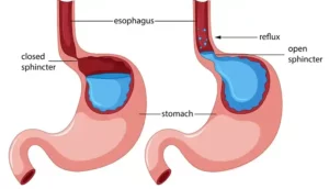 What is the role of HCL in our stomach Tastefullspace