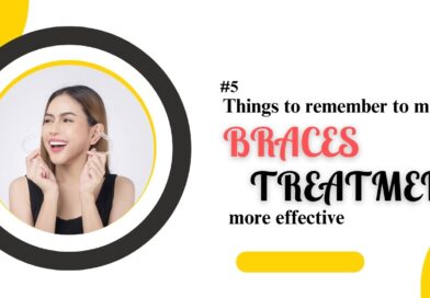 braces treatment