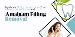 Detoxification and Amalgam Filling Removal